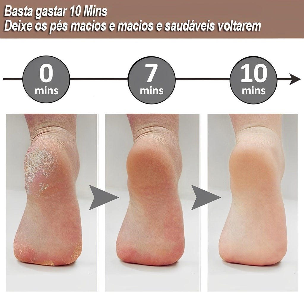 Velours Pieds – Appareil Électrique de Pédicure Rechargeable