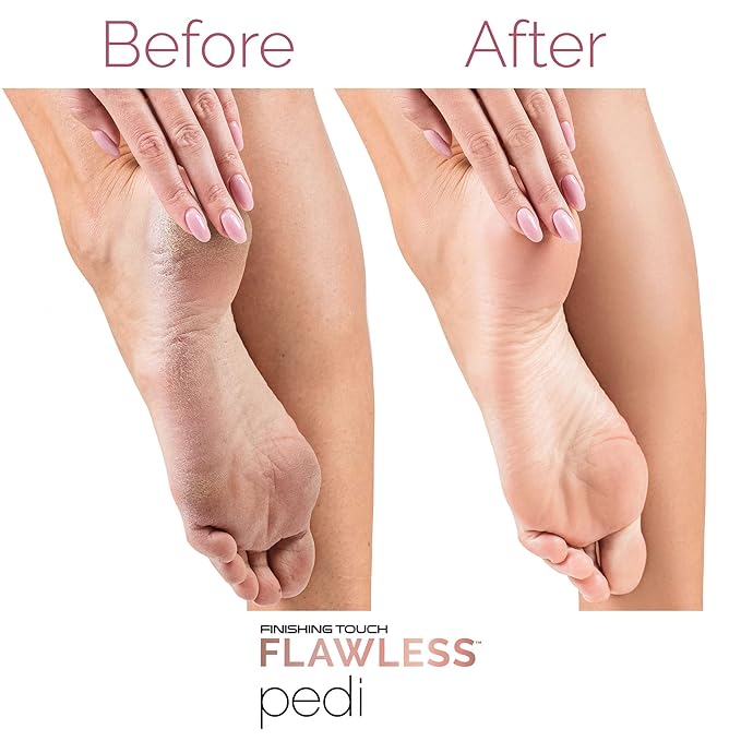Velours Pieds – Appareil Électrique de Pédicure Rechargeable